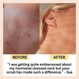 UpCircle USA - Exfoliating Vegan Face Scrub with Coffee, Citrus, + Rosehip